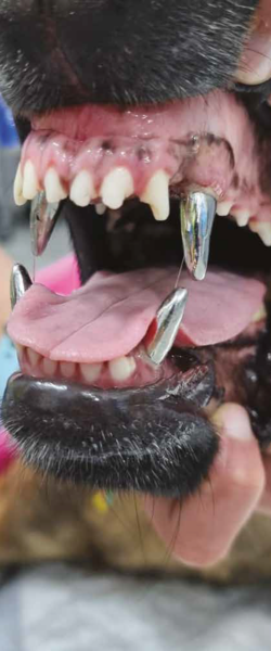 Fracturas dentales