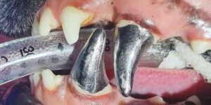 Fracturas dentales y su tratamiento mediante endodoncia